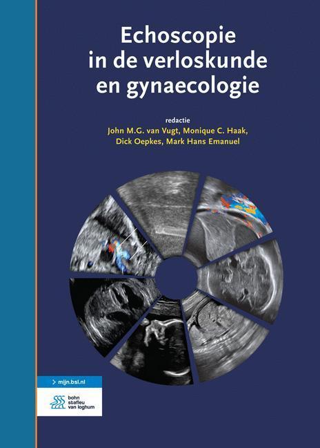 Echoscopie in de verloskunde en gynaecologie 9789036814508, Boeken, Wetenschap, Zo goed als nieuw, Verzenden