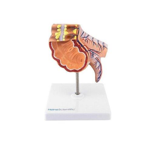 Anatomie model appendix en blinde darm, Sport en Fitness, Overige Sport en Fitness, Verzenden