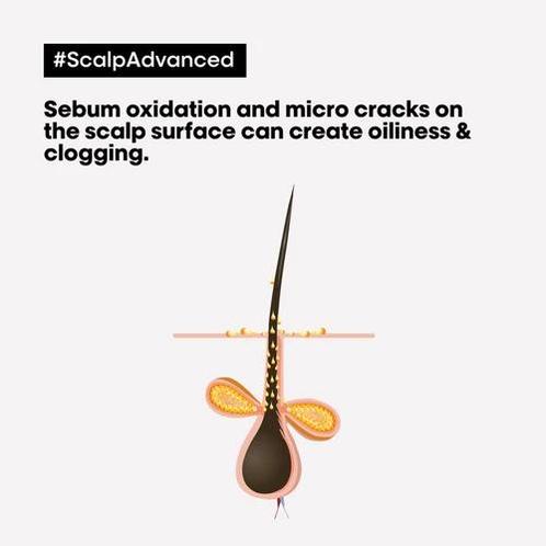 L&#039;Oréal Professionnel SE Scalp Advanced Dermo-purifi.., Sieraden, Tassen en Uiterlijk, Uiterlijk | Haarverzorging, Nieuw