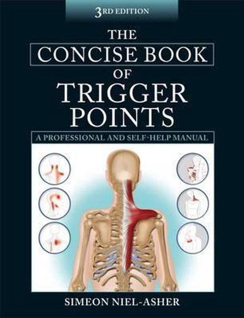 9781905367511 Concise Book Of Trigger Points 3E, Boeken, Studieboeken en Cursussen, Nieuw, Verzenden
