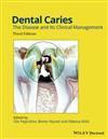 Dental Caries, 9781118935828, Verzenden, Zo goed als nieuw, Studieboeken
