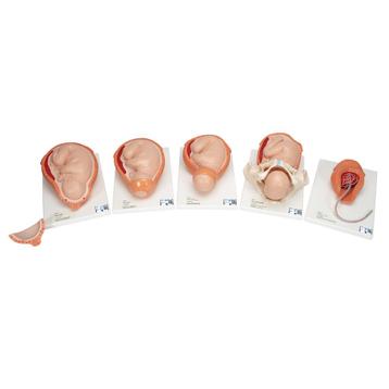 Anatomie model geboorte (complete serie van 5 modellen) beschikbaar voor biedingen