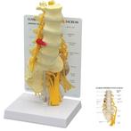 Anatomie model lumbale wervelkolom met hernia, Verzenden, Nieuw