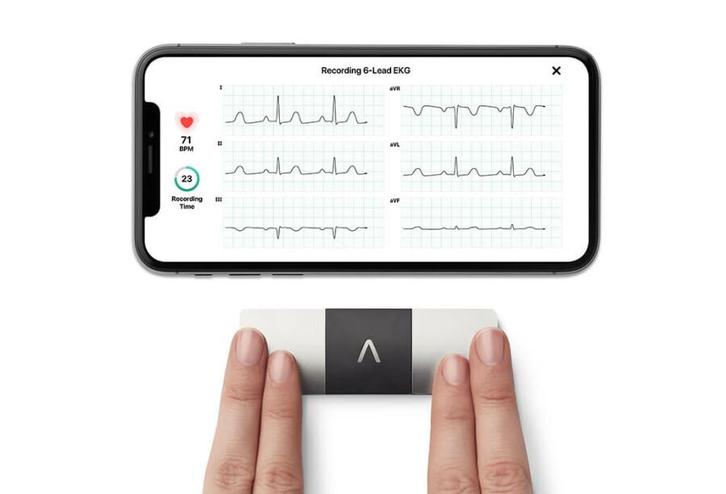 AliveCor Kardia Mobile 6L, 6 kanaals ECG apparaat, Diversen, Verpleegmiddelen, Nieuw, Verzenden