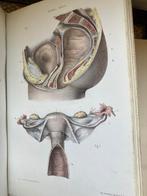 Adolphe Lenoir - Atlas de lart des accouchements - 1881, Antiek en Kunst
