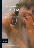 9789031387168 Leven met eczeem | Tweedehands, Verzenden, Zo goed als nieuw, P.E. Dirven-Meyer
