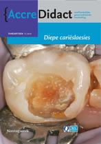 Diepe carieslaesies / AccreDidact / TA2014-1 9789089761460, Boeken, Verzenden, Zo goed als nieuw, E. Tijskens