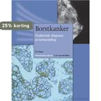 Borstkanker 9789085620068, Boeken, Verzenden, Zo goed als nieuw