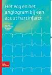 9789031378210 Het ECG en het angiogram bij een acuut hart...
