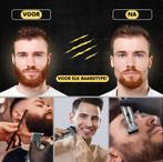 6-in-1 Baardtrimmer Mannen - Trimmer voor Baard en Lichaam -, Ophalen of Verzenden, Zo goed als nieuw