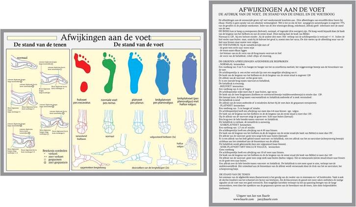 Anatomie poster voet en voetafwijkingen (Nederlands, gel..., Sport en Fitness, Massageproducten