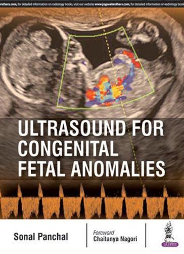 Ultrasound for Congenital Fetal Anomalies, Boeken, Studieboeken en Cursussen, Verzenden