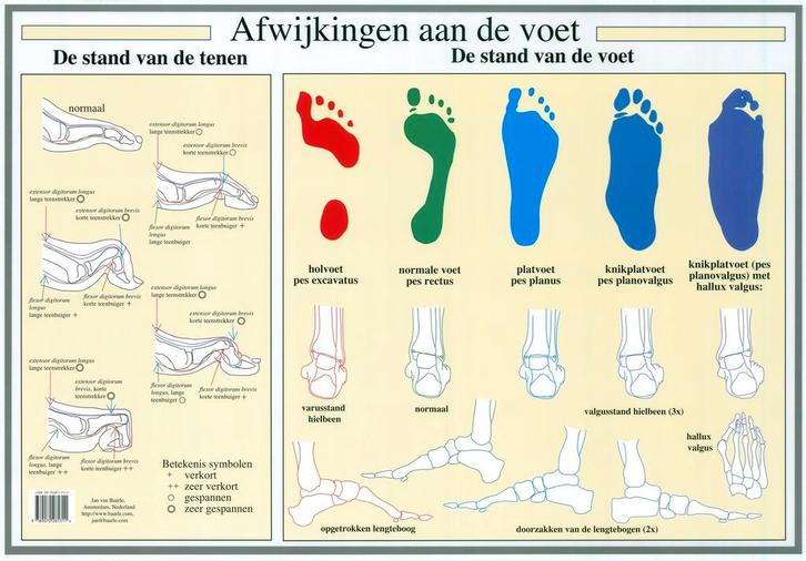 Anatomie poster voet en voetafwijkingen (Nederlands, gel..., Sport en Fitness, Massageproducten