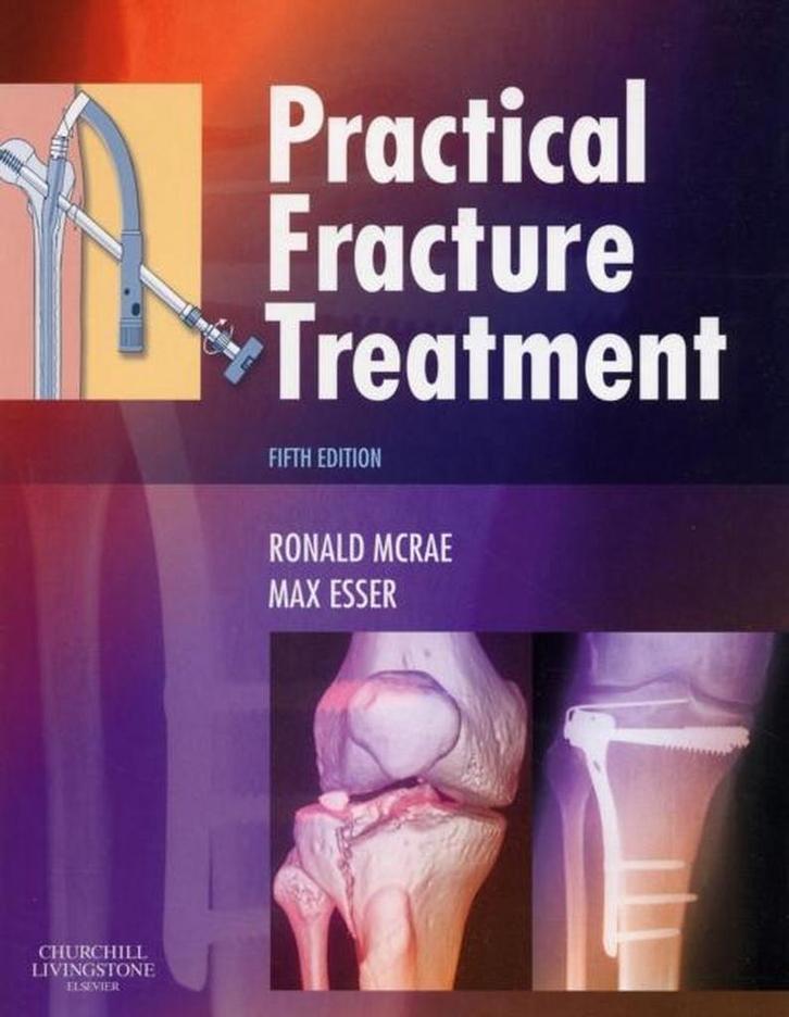 9780443068768 Practical Fracture Treatment | Tweedehands, Boeken, Schoolboeken, Zo goed als nieuw, Verzenden