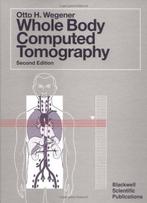 Whole-Body Computed Tomography 9780865422230 H. Wegener, Verzenden, Gelezen, H. Wegener