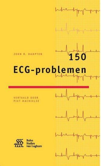 150 ECG-problemen | 9789036813730, Boeken, Studieboeken en Cursussen, Verzenden