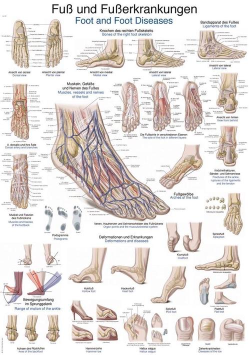 Anatomie poster voet en voetaandoeningen (50x70 cm), Sport en Fitness, Overige Sport en Fitness, Nieuw, Verzenden