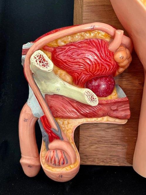 Anatomisch model - somso-plast - 1980-1990, Antiek en Kunst, Antiek | Wandborden en Tegels