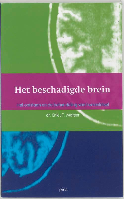 Het beschadigde brein 9789077671016 E.J.T. Matser, Boeken, Gezondheid, Dieet en Voeding, Gelezen, Verzenden
