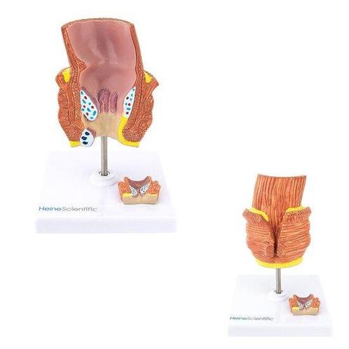Anatomie model aambeien, Sport en Fitness, Overige Sport en Fitness, Verzenden