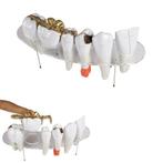 Anatomie model gebit, 10x ware grootte, 7-delig, Verzenden, Nieuw