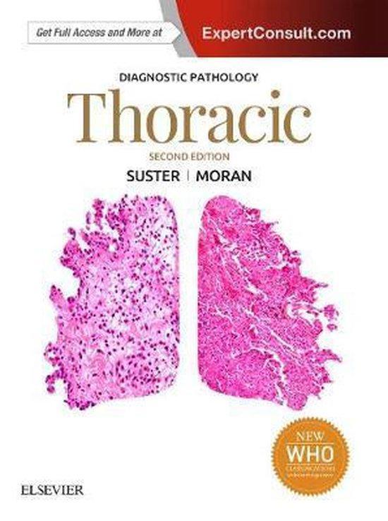 9780323377157 Diagnostic Pathology Saul Suster, Boeken, Studieboeken en Cursussen, Nieuw, Verzenden