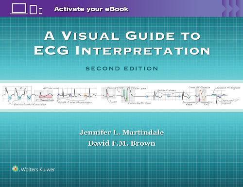 A Visual Guide to ECG Interpretation, Boeken, Studieboeken en Cursussen, Verzenden