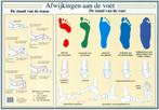 Anatomie poster voet en voetafwijkingen (NL, A2), Nieuw, Verzenden