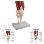 Anatomie model kniegewricht met spieren, Nieuw, Verzenden