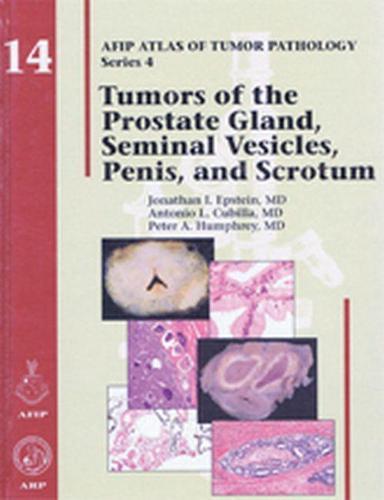 Tumors of the Prostate Gland  Seminal Vesicles  Penis  and, Boeken, Studieboeken en Cursussen, Verzenden