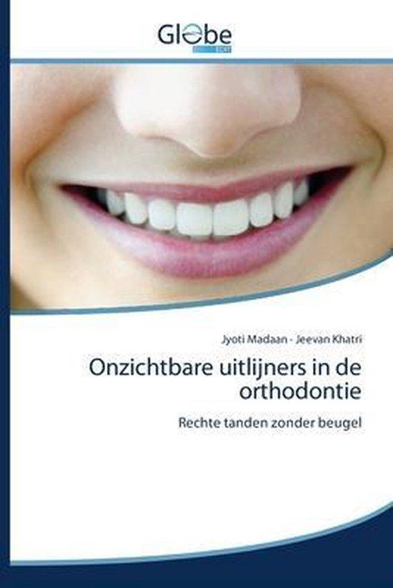 9786139419623 Onzichtbare uitlijners in de orthodontie, Boeken, Schoolboeken, Zo goed als nieuw, Verzenden