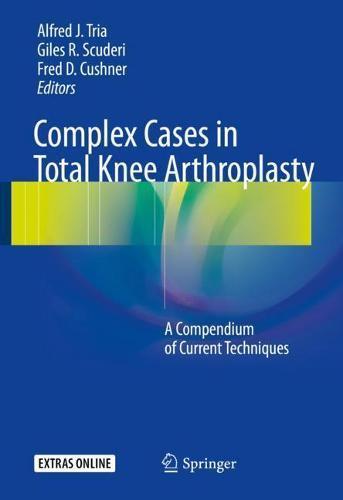 Complex Cases in Total Knee Arthroplasty: A Compendium of, Boeken, Studieboeken en Cursussen, Verzenden
