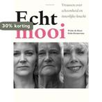 Echt mooi 9789056151812 W. de Haan, Boeken, Verzenden, Gelezen, W. de Haan