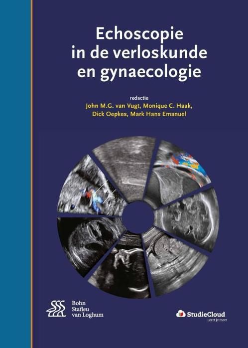 Echoscopie in de verloskunde en gynaecologie, 9789036814508, Boeken, Studieboeken en Cursussen, Zo goed als nieuw, Verzenden