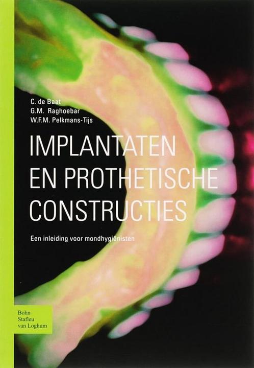 Implantaten en prothetische constructies 9789031343812, Boeken, Wetenschap, Zo goed als nieuw, Verzenden