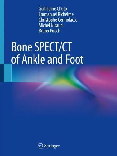 Bone SPECT/CT of Ankle and Foot, Boeken, Studieboeken en Cursussen, Verzenden