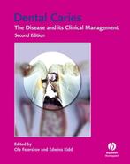 Dental Caries 9781405138895, Boeken, Verzenden, Zo goed als nieuw