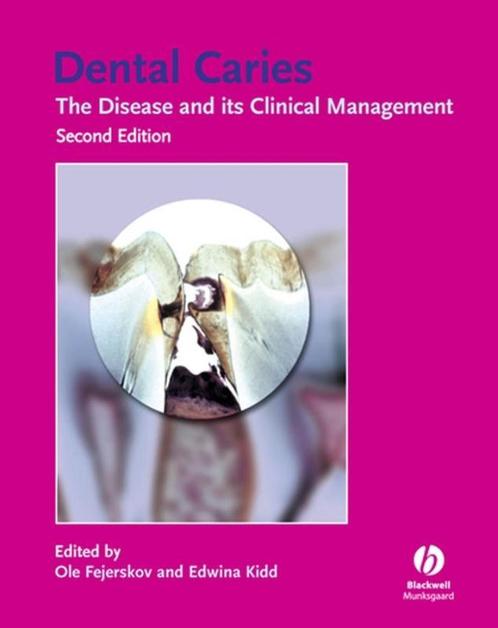 Dental Caries 9781405138895, Boeken, Wetenschap, Zo goed als nieuw, Verzenden