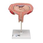 Anatomie model zwangerschap, 5e maand foetus (dwarsligging), Verzenden, Nieuw