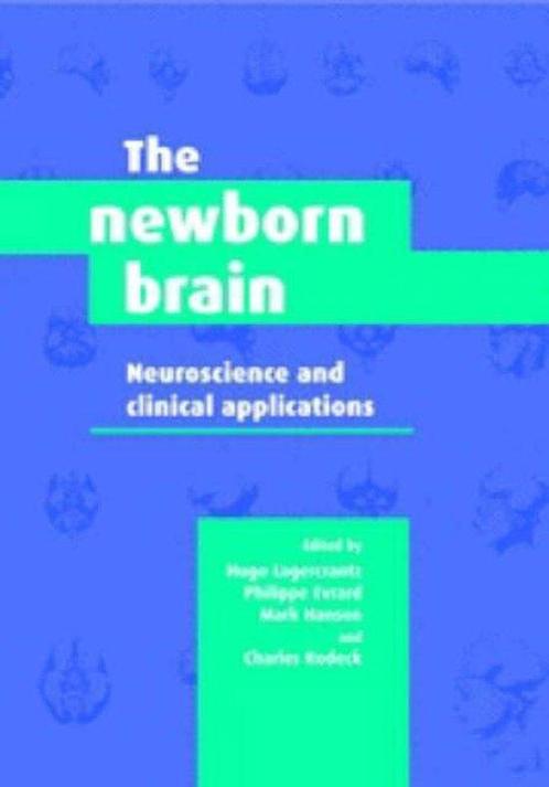 The Newborn Brain 9780521793384, Boeken, Taal | Engels, Gelezen, Verzenden