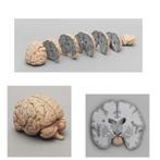 Anatomie model hersenen, frontale doorsnedes, Nieuw, Verzenden