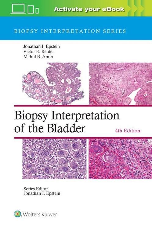 9781975199203 Biopsy Interpretation Series- Biopsy Interp..., Boeken, Studieboeken en Cursussen, Nieuw, Verzenden