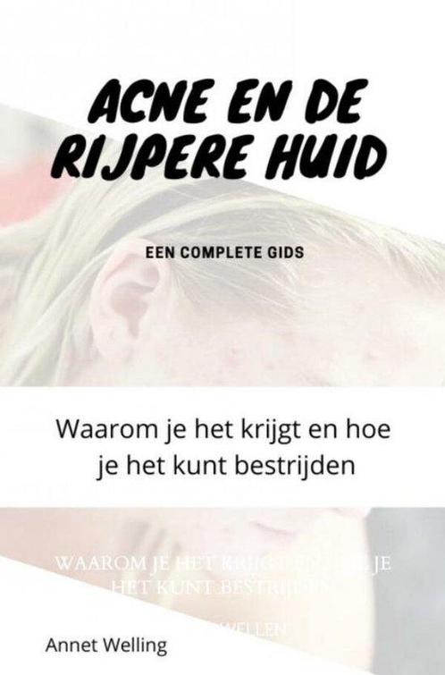 9789403651262 Acne bij volwassenen Annet Wellen, Boeken, Studieboeken en Cursussen, Nieuw, Verzenden