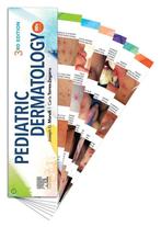 9780323680950 Pediatric Dermatology DDX Deck, Verzenden, Nieuw, Joseph Morelli