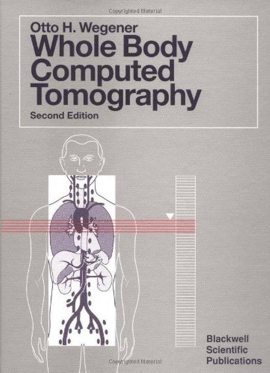 Whole-Body Computed Tomography 9780865422230 H. Wegener, Boeken, Taal | Engels, Gelezen, Verzenden