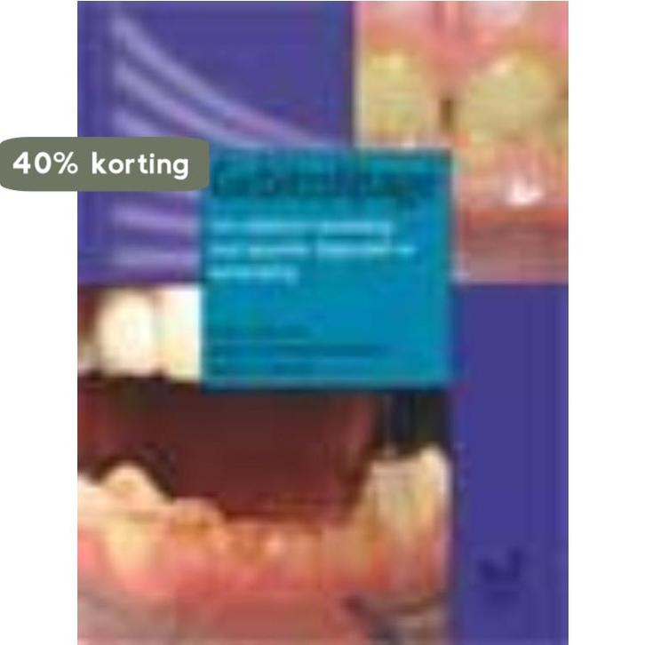 Gebitsslijtage 9789085620204 A. van Nieuw Amerongen, Boeken, Wetenschap, Zo goed als nieuw, Verzenden