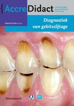 Diagnostiek van gebitsslijtage / AccreDidact / TA2015-2, Verzenden, Zo goed als nieuw, Peter Wetselaar