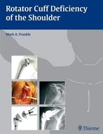 Rotator Cuff Deficiency of the Shoulder, Verzenden, Nieuw
