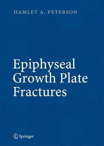 Epiphyseal Growth Plate Fractures, Boeken, Studieboeken en Cursussen, Verzenden