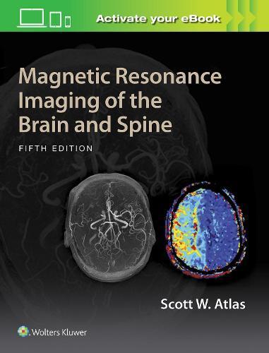 Magnetic Resonance Imaging of the Brain and Spine, Boeken, Studieboeken en Cursussen, Verzenden